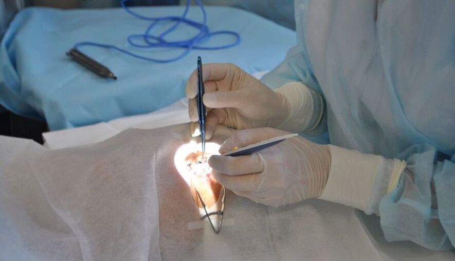 Eye surgery helps restore vision