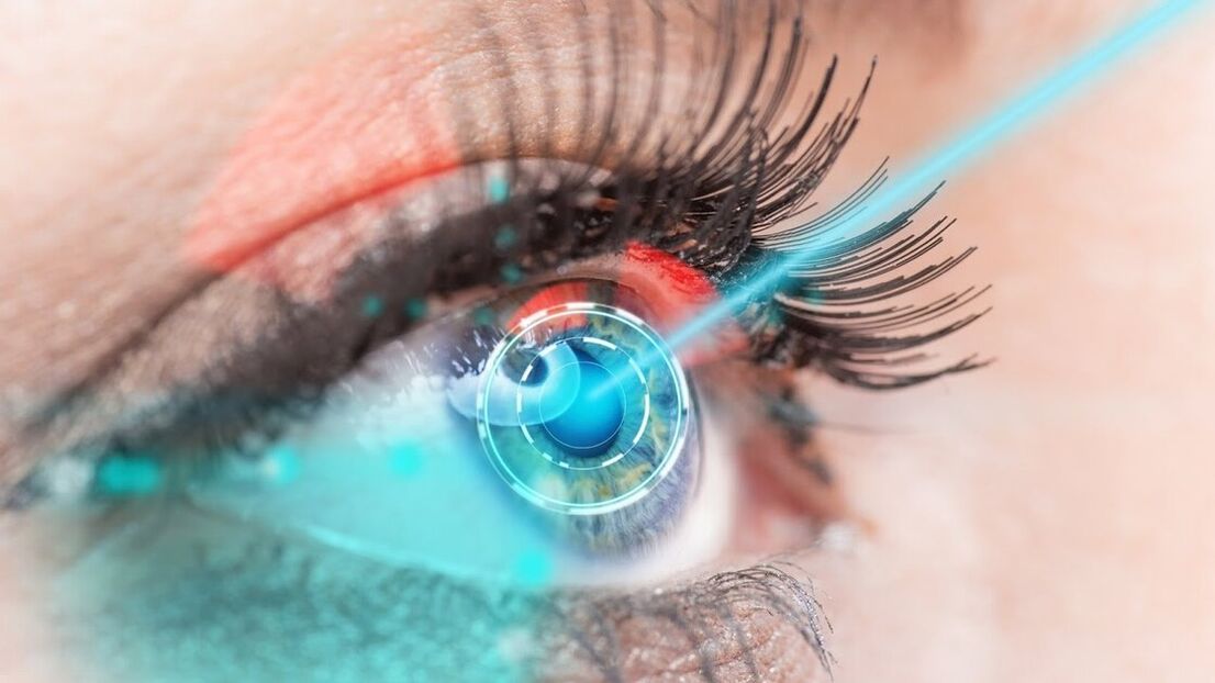 Restore vision with laser correction